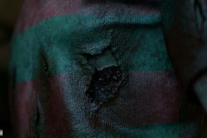 Unreal Engine – Zombie Bloated Male UE5335